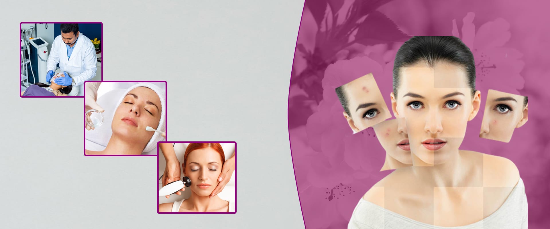 Best Skin Clinics Hospitals In Madurai » Glow Skin Clinic